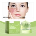 thumbnail image 4 of Gel hidratante de centella asiática que retiene el agua e hidrata. Suero facial calmante y calmante. 50 g., 4 of 4