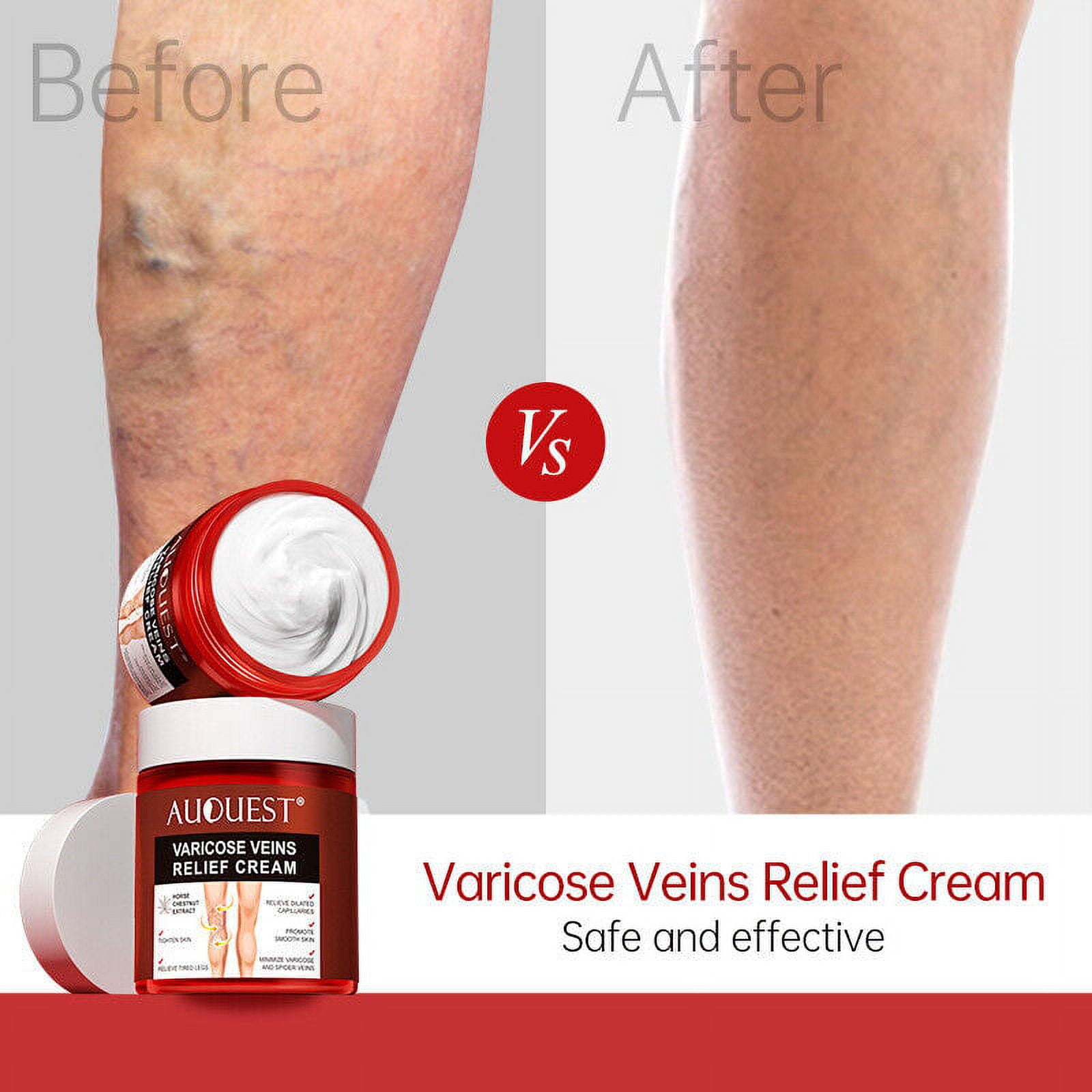 AUQUEST- Varicose Veins Relief Cream Vasculitis Phlebitis Spider Pain Relief Ointment Medical Plaster Body Care- 80g