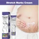 thumbnail image 5 of Crema de eliminación permanente, elimina las estrías del vientre corporal para túneles, eficaz, elimina las estrías, 5 of 5