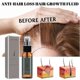 thumbnail image 2 of Hair Growth Solution Strengthen Hair Nourish Hair Roots Grow Thick Damage Repair Ginger Hair Treatment 30Ml Box, 2 of 5