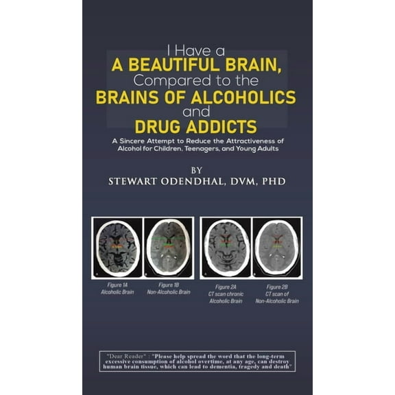 I Have a Beautiful Brain, Compared to the Brains of Alcoholics and Drug Addicts, (Hardcover)
