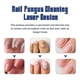 thumbnail image 2 of Instrumento de reparación de uñas Aparato de engrosamiento de reparación de uñas Promueve la uña 3 * dispositivos de enfermería, 2 of 5