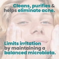 thumbnail image 4 of Gel limpiador Avene Cleanance Acne Clearing 200 ml Sensitive, 4 of 5