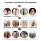 thumbnail image 4 of 1/2/3Pcs Nail Fungal Treatment Feet Care Essence Nail Foot Care Toe Nail Fungus Removal Gel Anti Infection Paronychia Onychomycosis, 4 of 5