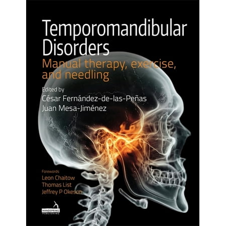 UPC: 9781909141803 | Temporomandibular Disorders : Manual Therapy  Exercise and Needling