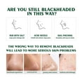 Gentle Blackhead Removing For Moisturizing Oil Control And Deep Pore