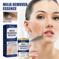 thumbnail image 2 of Eye and Sebaceous Remover, 30ml Solution for Effective Cleaning, 2 of 5