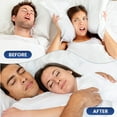 thumbnail image 6 of OhmRx Sleeping Mouth Tape, 30-Count I-Shape Anti-Snoring Strips, Tan, 6 of 9