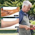 thumbnail image 3 of 2 pairs of arm skin protection sleeves arm protectors for thin skin and bruises 2 pairs of arm skin protection sleeves arm protectors for thin skin and bruises Smart Technology, 3 of 5