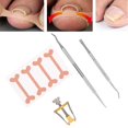 thumbnail image 4 of Corrector De Uñas Encarnadas Corrector De Uñas Encarnadas Herramienta De Limpieza De Uñas Encarnadas Parche De Corrección De Uñas De Los Pies Corrector De Uñas De Los Ccdes Otros, 4 of 8
