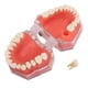 thumbnail image 3 of Modelo de encía ANGGREK Dientes removibles, 3 of 8