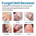 thumbnail image 4 of Nail Repair Spray Repair And Clean Nails, Hands, Feet, Soft Nails, Thicken Nails, Polish Nails, 100ml, 4 of 5