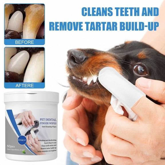 Pet Dental Finger Wipes For Dogs, Dog Mouth Cleaning Wipes With Finger Cover, 50 Count Pet Oral Care Finger Wipes For Removing Bad Breath, Plaque And Tartar, Dog Finger Wipes For