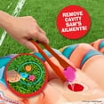 thumbnail image 6 of Hasbro Operation Splash Game by WowWee – Family Game for your Yard – More Water, More Fun!, 6 of 8