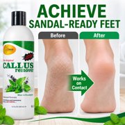 SPA REDI - Callus Remover for Feet Gel, Mint and Eucalyptus, 12 Oz - Professional Pedicure Foot Care - Removes Toughest Calluses in Seconds and Smooths Dry Cracked Heels