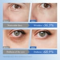 thumbnail image 4 of Brillo de ojos, crema reparadora de arroz para el contorno de ojos, reduce la hinchazón, las ojeras y reafirma la zona. 20 g por unidad., 4 of 8