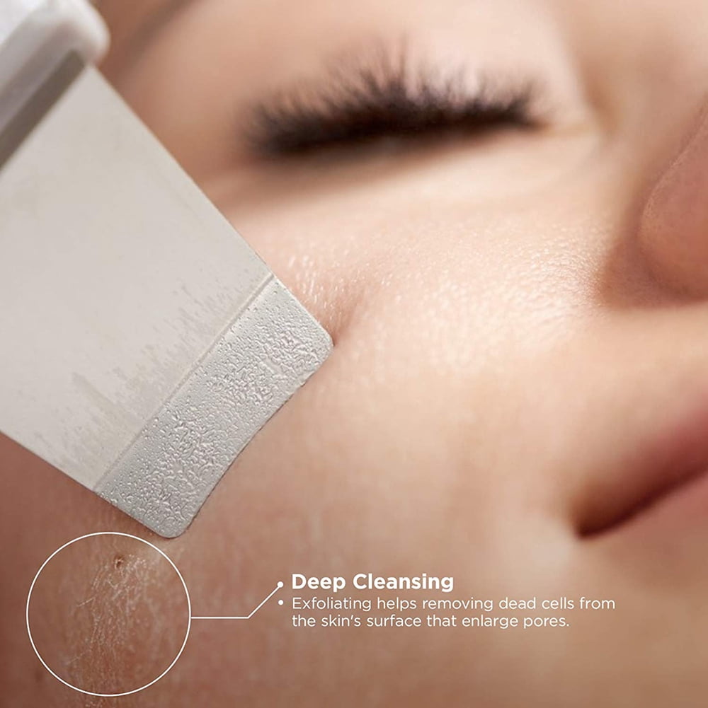 Ultrasonic Face Skin Scrubber Facial Cleaner Skin Peeling Blackhead Removal Revitalize Your Face Naturally