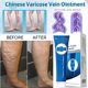 thumbnail image 5 of Crema Para El Tratamiento De Las Venas Varicosas De 20g ANGGREK aricosity Angiitis Ointment, 5 of 7