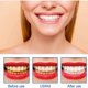 thumbnail image 2 of Tooth Whitening Essence, 2 of 5