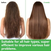 Aliver Rosmarinus Shampoo & Conditioner Set, Strengthening Hair, Gently Cleanses Scalp and Strengthen Weak and Brittle Hair, 10.5+10.5 fl.oz