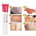 thumbnail image 4 of Crema Para Eliminar Cicatrices, Reparar Cicatrices Regain Beauty Gel Reparador Corporal Suave Para Reparar Cicatrices De Quemaduras ANGGREK Oro, 4 of 8