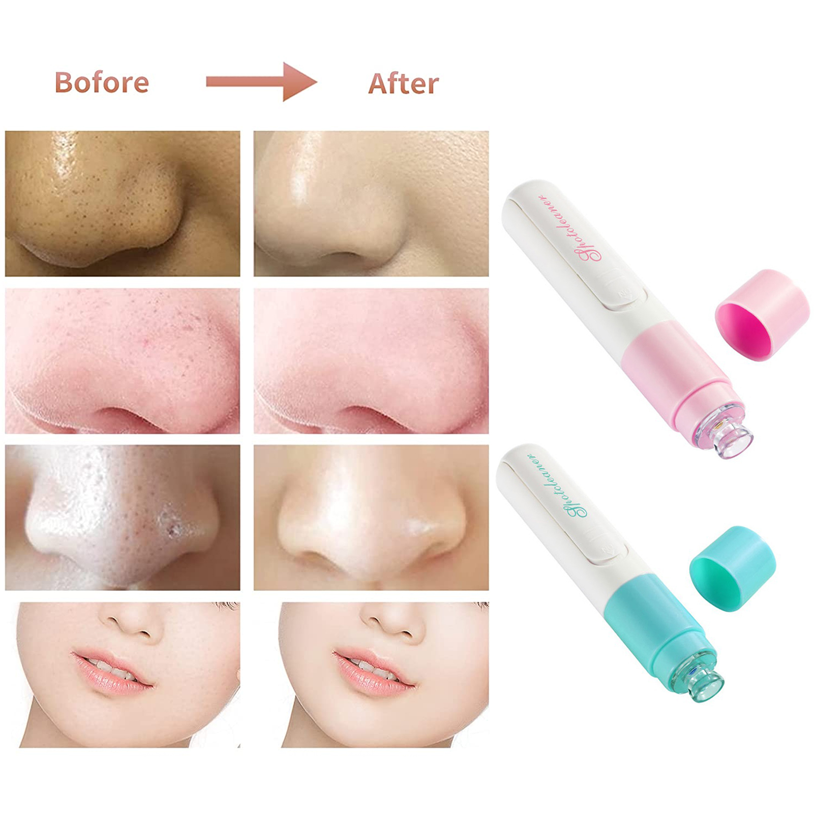 Taluosi Electric Face Cleaner Pore Cleaning Mini Blackhead Remover Face Dirt Pore Cleaner for Home Use