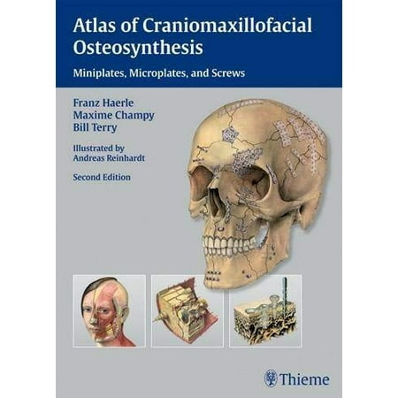 UPC: 9783131164926 | Atlas of Craniomaxillofacial Osteosynthesis: Microplates  Miniplates and Screws – Terry  Bill
