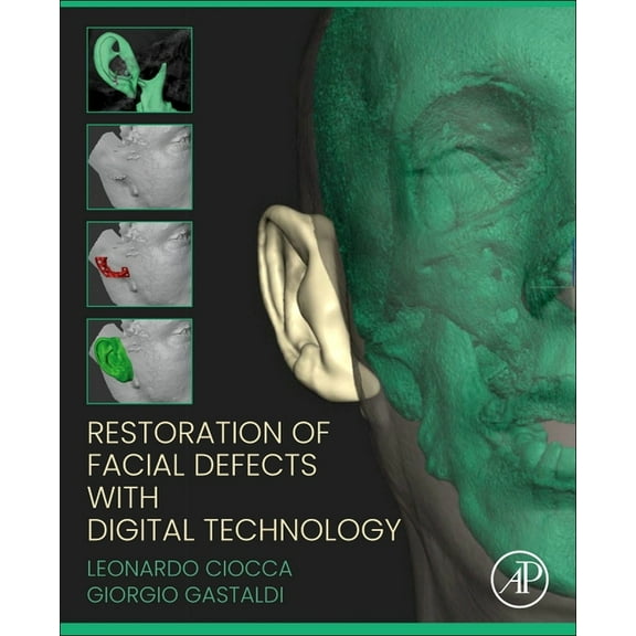 Restoration of Facial Defects with Digital Technology, (Paperback)