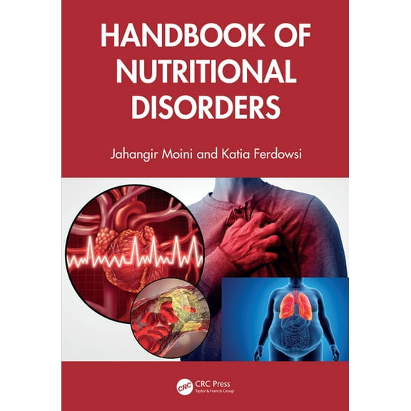 Handbook of Nutritional Disorders, (Paperback)