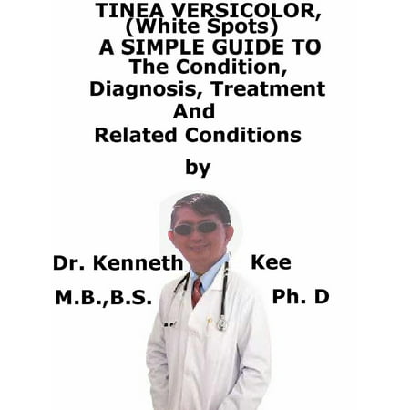 Tinea Versicolor, (White Spots) A Simple Guide To The Condition, Diagnosis, Treatment And Related Conditions -