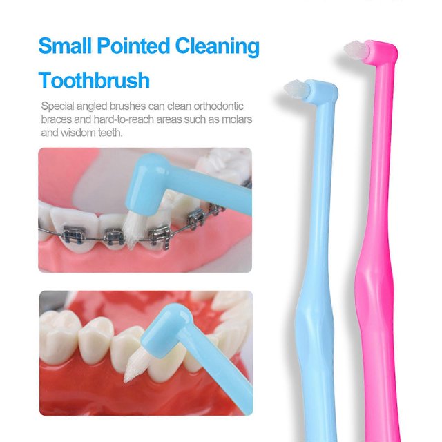 2-pack orthodontic care cleaning toothbrush irregular small pointed toothbrush braces special toothbrush (rose red + blue)