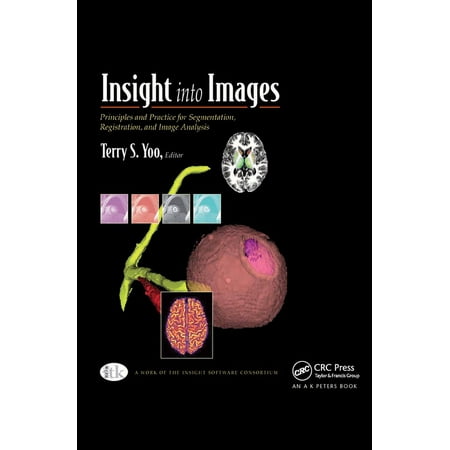 UPC: 9781568812175 | Insight Into Images: Principles and Practice for Segmentation  Registration  and Image Analysis (Hardcover)
