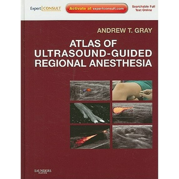 Atlas of Ultrasound-Guided Regional Anesthesia (Hardcover)