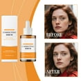 thumbnail image 5 of Dark Spots Correcting Serum Dark Spots Improver For Face And Body 30ml, 5 of 8