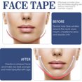 thumbnail image 3 of Parche Lifting Facial Reafirmante Y Lifting La Flacidez La Piel Del Rostro Parche Lifting Facial Antiarrugas Pliegues Nasolabiales Y Líneas Finas, 3 of 9
