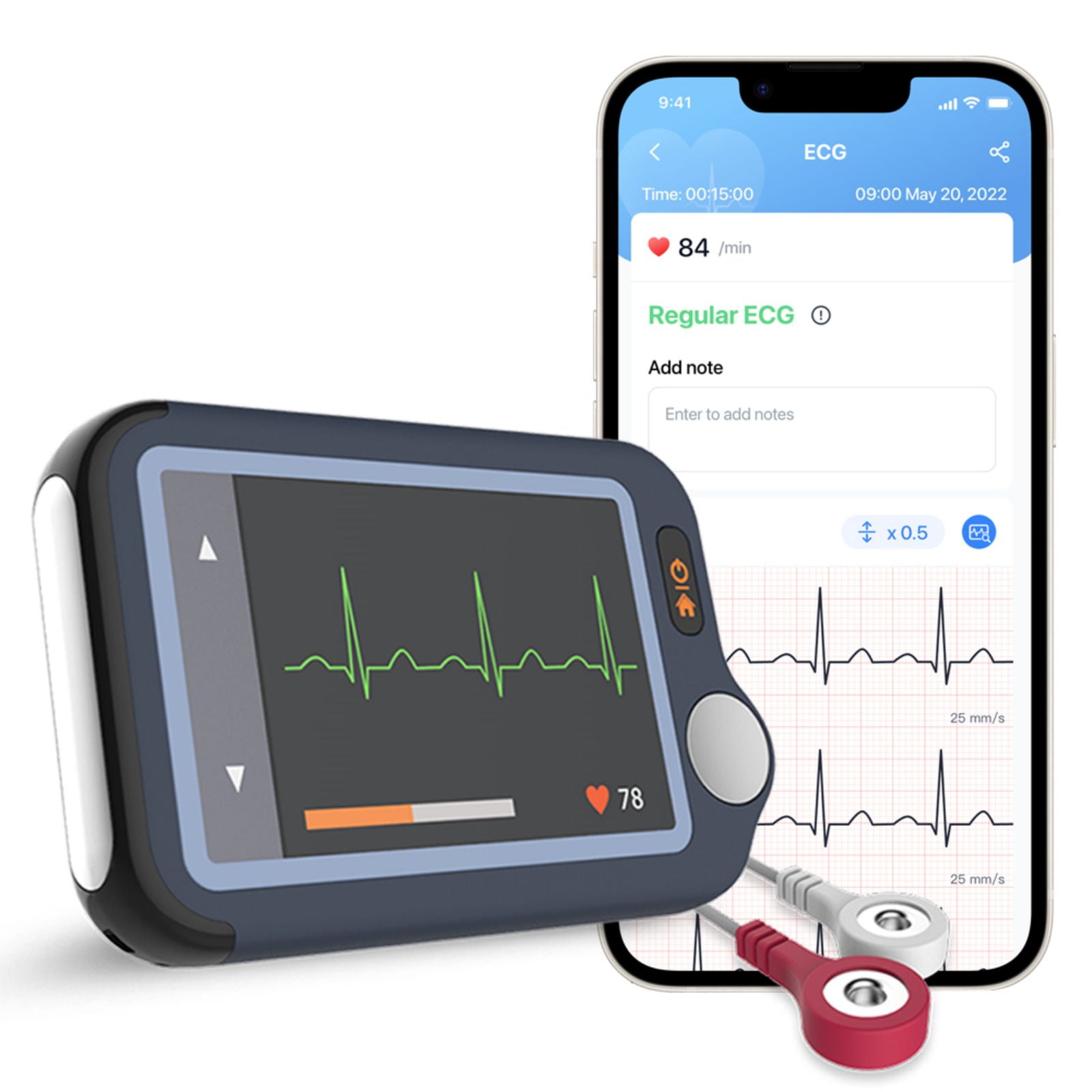 Remote ECG monitoring devices for cardiac health