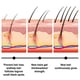 thumbnail image 4 of Jaysuing Batana Mi Hair Ball urishing Hair Root Thick Hair Strong And Firm Hair Scalp Massage Care |, 4 of 4