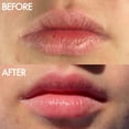 thumbnail image 3 of Bálsamo labial Lanolips 101 Ointment Multi-Balm Duo, 15 ml (paquete de 2), 3 of 9