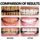 thumbnail image 2 of 2-3pcs Gum Regrowth Foam Repair Gingival Teeth Whiten Remove Yellow Stain Relieve Dental Decay Toothache Oral Cleaning Protect Gum Care, 2 of 5