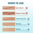 thumbnail image 3 of LotFancy Silicone Scar Sheets, 10 Pcs Silicone Scar Tape for Scar Treatment, Reusable, 4 x 7 in, 3 of 8
