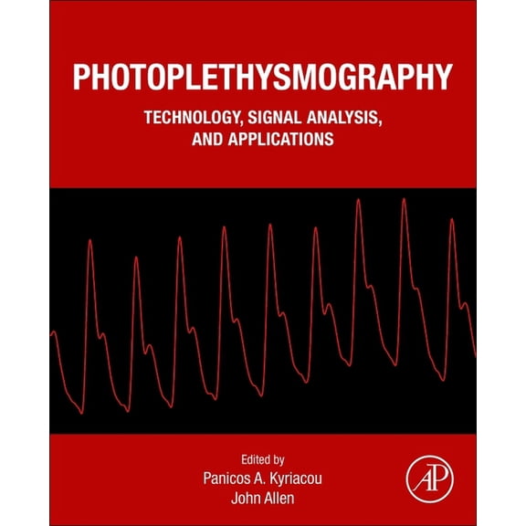 Photoplethysmography: Technology, Signal Analysis and Applications, (Paperback)