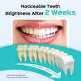 thumbnail image 3 of Irrigador bucal COSLUS, hilo dental multifunción con pastillas blanqueadoras, herramienta de limpieza dental, irrigador bucal eléctrico para el hogar., 3 of 8