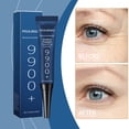 thumbnail image 3 of Crema para ojos para eliminar patas de gallo y ojeras. Crema termofusible para eliminar arrugas. Crema para ojos 15 g., 3 of 4