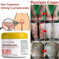 thumbnail image 4 of Crema antihongos para Psoriasis, tratamiento de infección por hongos para la piel, crema médica para Psoriasis, pomada para el tratamiento de picazón de la piel, 4 of 5