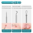 Super Tip Cell Clip Acne Needle Set Ultrafine Tweezers
