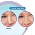 thumbnail image 4 of DR.RASHEL Bandes pour Pores du Nez à l'Acide Hyaluronique, 20 Pcs, 4 of 5