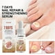 thumbnail image 4 of Suero para el crecimiento y fortalecimiento de uñas de 7 días, reparador de uñas, para el crecimiento de las uñas de los pies, para reparar uñas dañadas y descoloridas (20 ml), 4 of 4