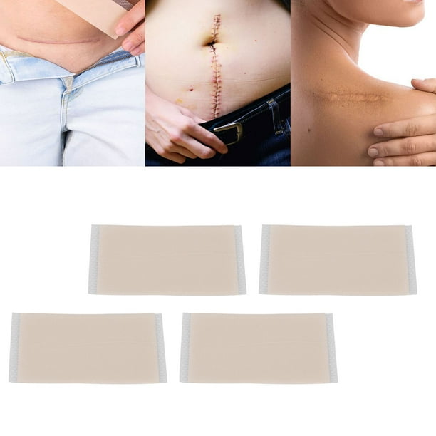 HOJAS DE ELIMINACIÓN DE CICATRICES DE SILICONA, TRATAMIENTO DE TRATAMIENTO DE CICATRICES DE SILICONA PROFESIONAL LIGERO Conveniente para la Sección C