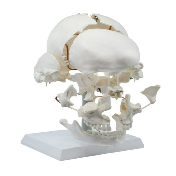 Beauchene Exploded Skull Model - 13 Parts - Life Size - Mounted on Articulated Stand - Eisco Labs