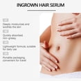 thumbnail image 3 of Hair Removal And Soothing Essence, Moisturizing, Soothing And Gentle Repair Refreshing And Smooth Skin Care Ball Essence, 3 of 5